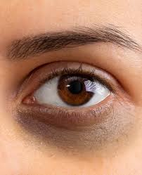 Digital Eye Strain? Eye Specialist in Wakad Shares Screen-Safe Habits 4 Why Do Eyes Twitch?