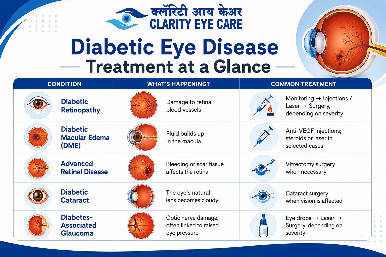 Diabetic Eye Disease Treatment: What Are Your Options? 1 What Are the Treatment Options for Diabetic Eye Disease